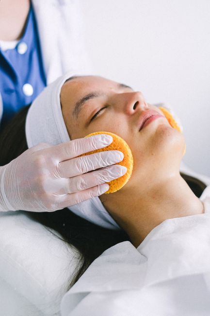 Peeling Químico